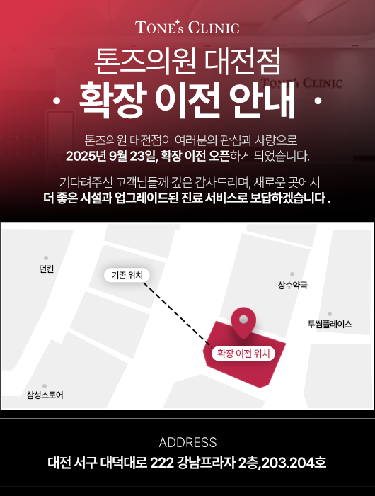 팝업